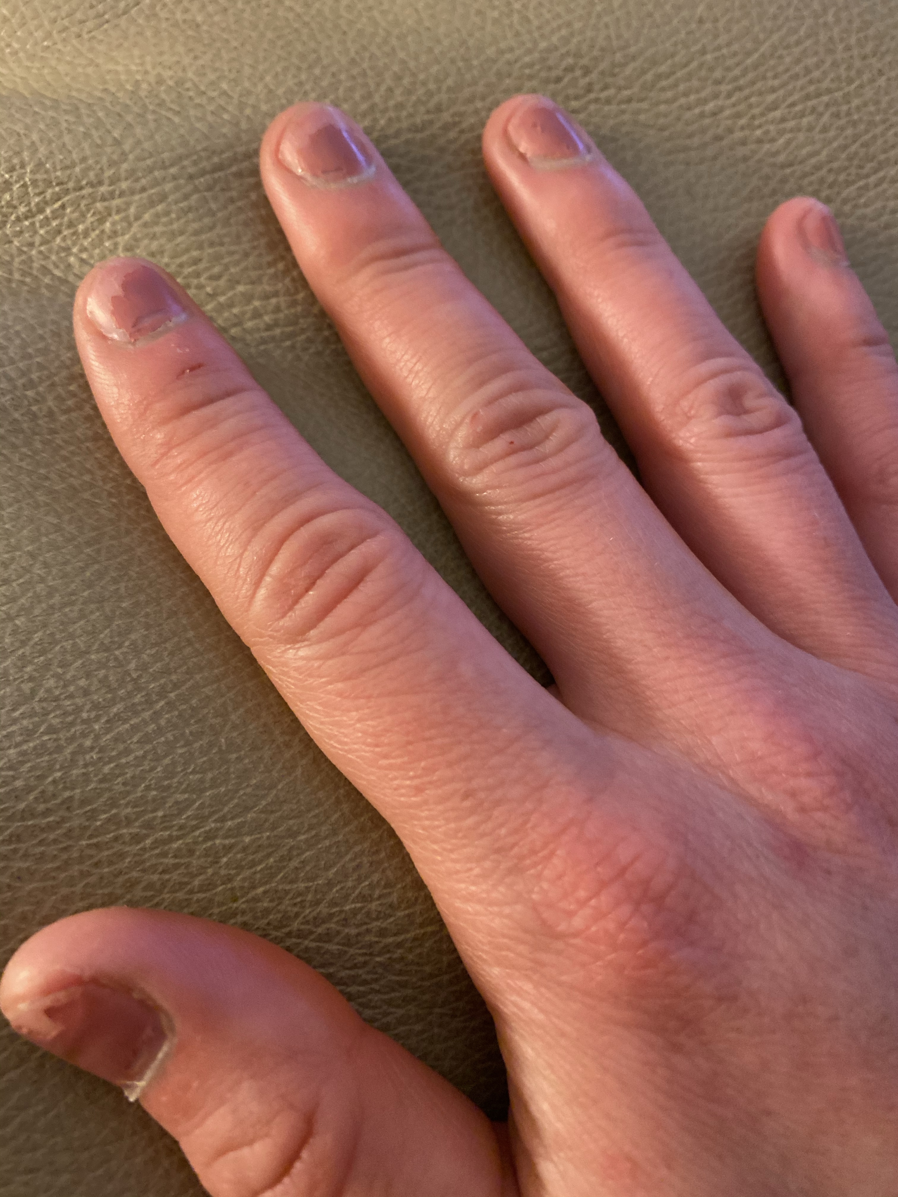 picture of woman's hand after seaweed harvesting