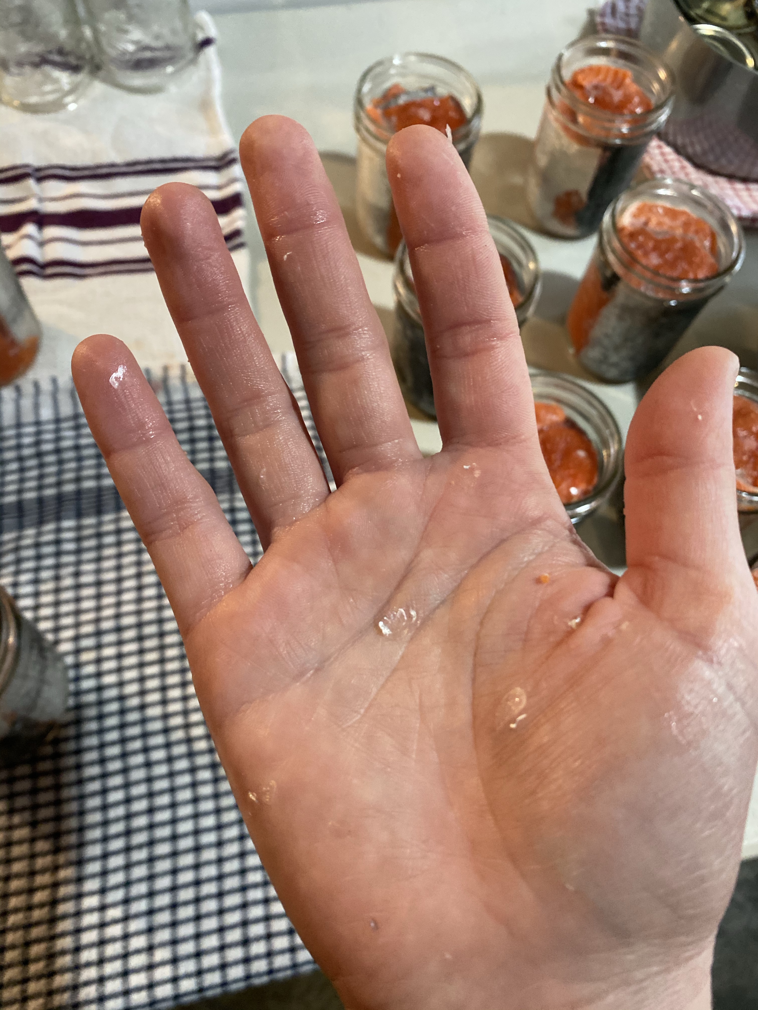 A hand has been covered in scales